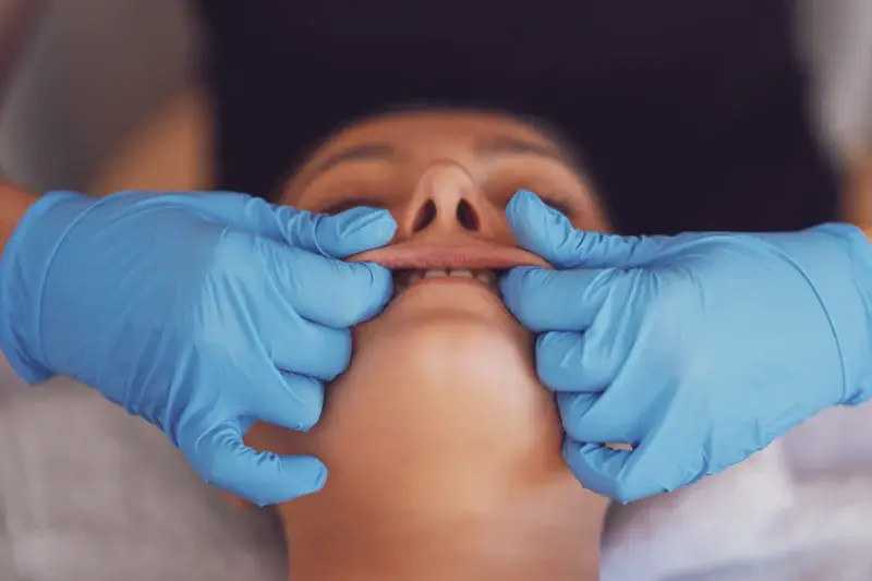 Buccal Massage — Manual Therapies, Frederiksberg